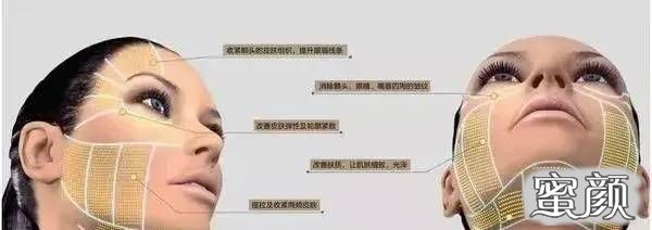 https://img.miyanlife.com/mnt/timg/200721/1135054L4-8.jpg