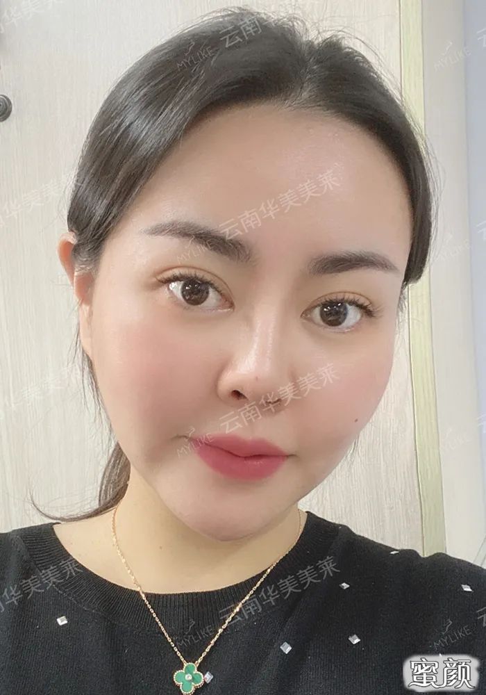 https://img.miyanlife.com/mnt/timg/200721/11350VE8-13.jpg