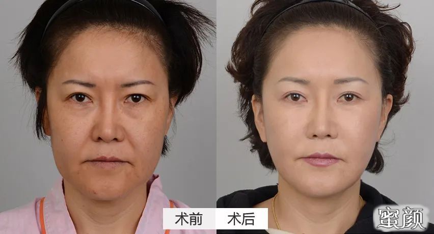https://img.miyanlife.com/mnt/timg/200724/124P42628-13.jpg