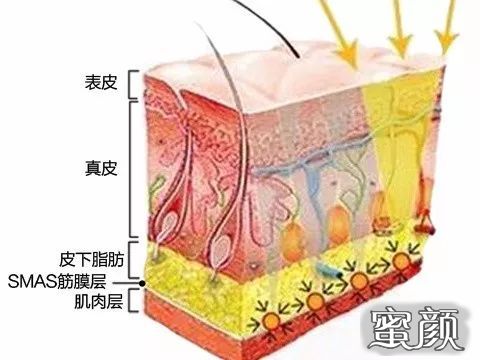 案例图片