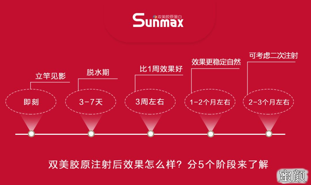 https://img.miyanlife.com/mnt/timg/200724/1404325Y8-0.jpg