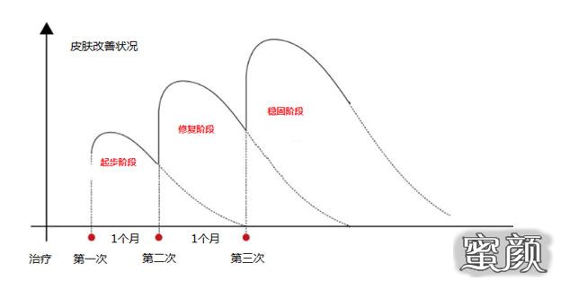 https://img.miyanlife.com/mnt/timg/200724/1404336263-1.jpg