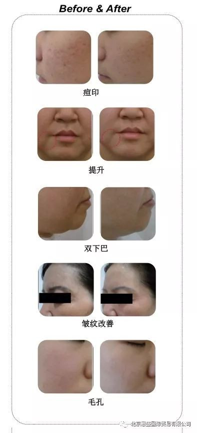 https://img.miyanlife.com/mnt/timg/200727/1312302408-11.jpg