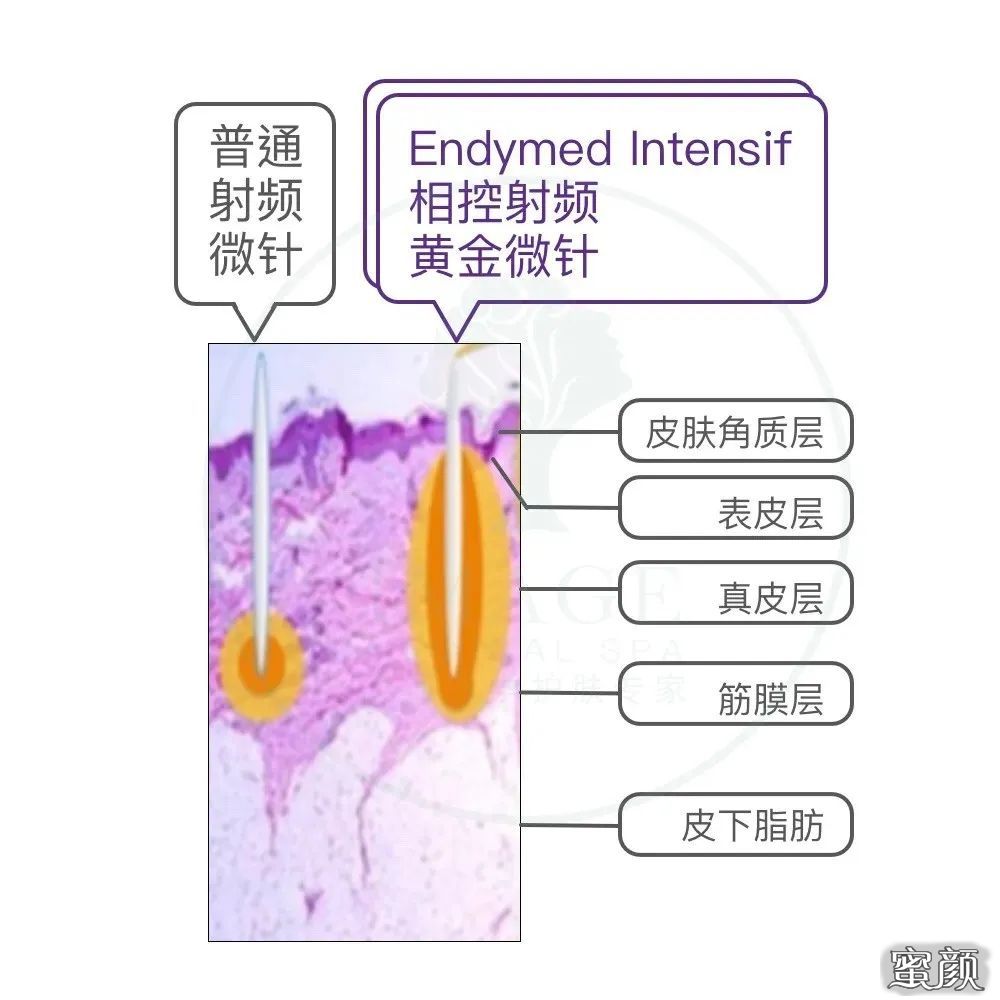 案例图片