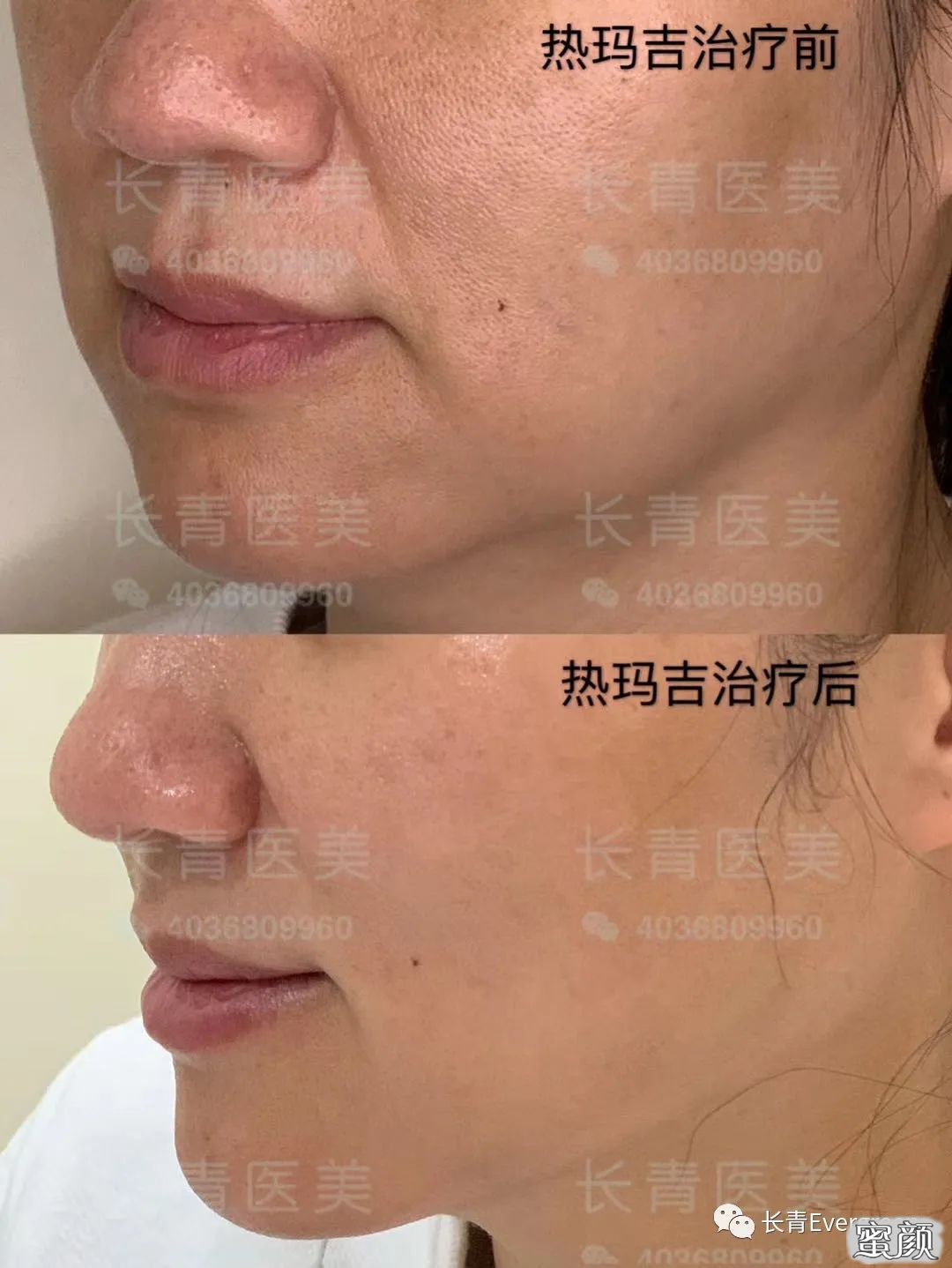 https://img.miyanlife.com/mnt/timg/200728/1354055J4-6.jpg