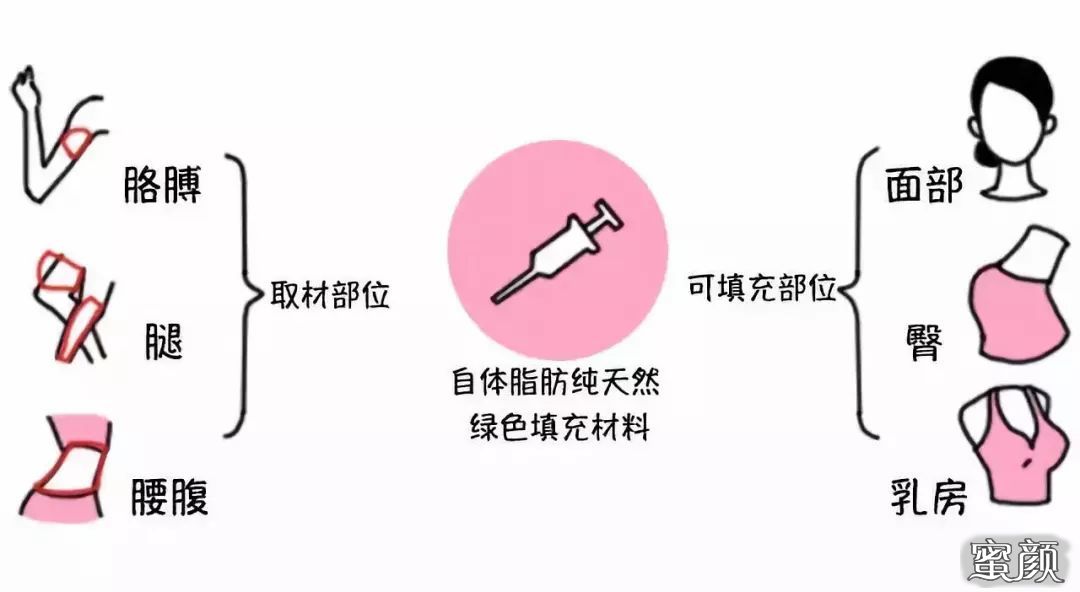 https://img.miyanlife.com/mnt/timg/200730/140ZGF4-8.jpg