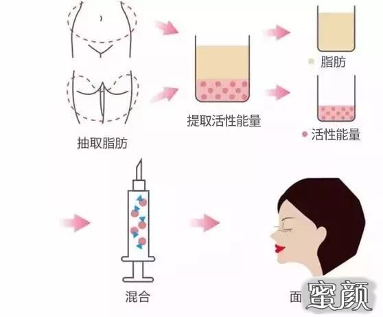 https://img.miyanlife.com/mnt/timg/200730/140ZT3Q-9.jpg
