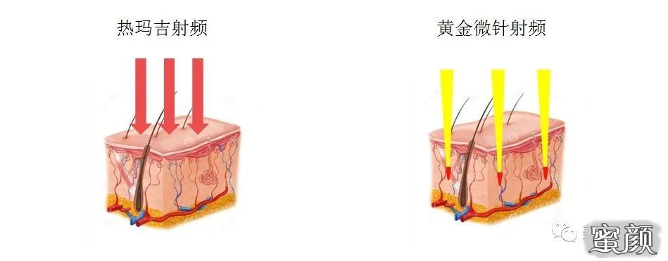 https://img.miyanlife.com/mnt/timg/200801/130GIF9-1.jpg