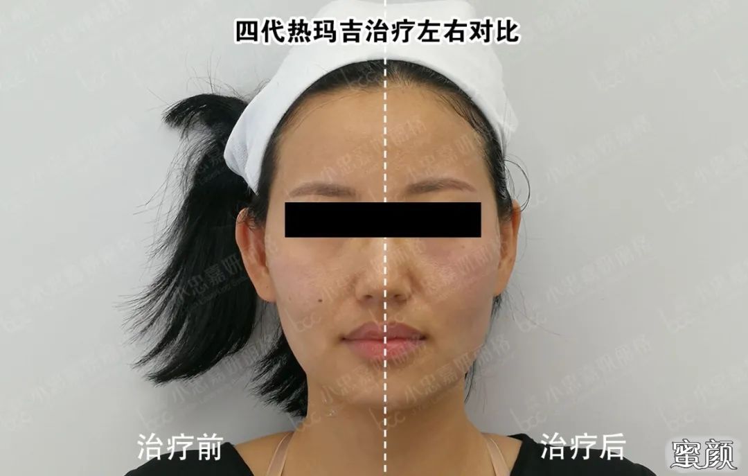 https://img.miyanlife.com/mnt/timg/200801/1315141253-4.jpg