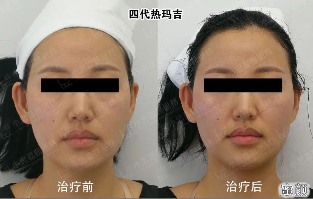https://img.miyanlife.com/mnt/timg/200801/131514J08-5.jpg