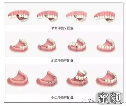 案例图片