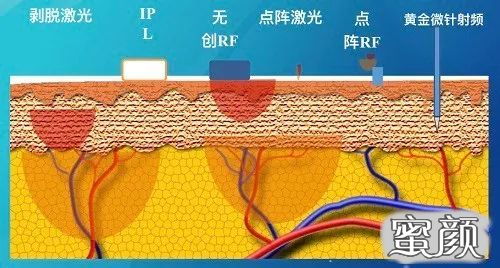 https://img.miyanlife.com/mnt/timg/200805/105012EV-3.jpg