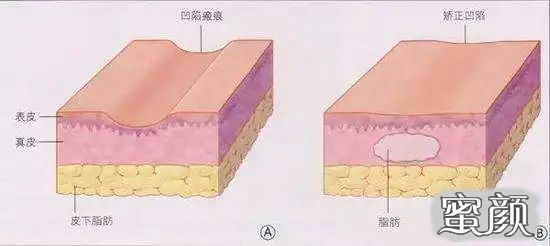 案例图片