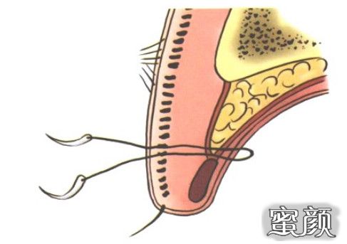 https://img.miyanlife.com/mnt/timg/200805/11534944S-1.jpg