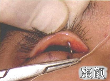 https://img.miyanlife.com/mnt/timg/200805/115352E50-3.jpg