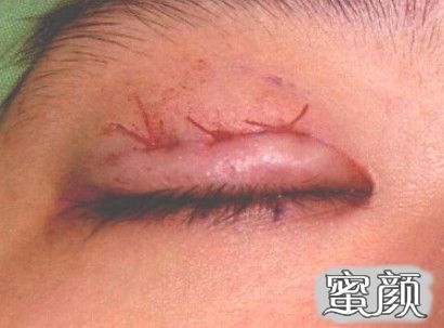 https://img.miyanlife.com/mnt/timg/200805/1153563221-8.jpg