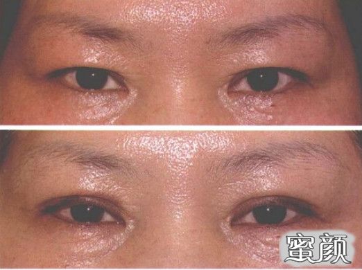 https://img.miyanlife.com/mnt/timg/200805/1153596293-9.jpg
