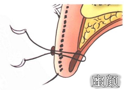 https://img.miyanlife.com/mnt/timg/200805/1154034921-12.jpg