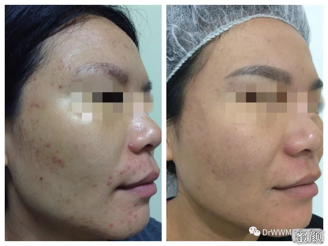 https://img.miyanlife.com/mnt/timg/200805/1206013V7-3.jpg