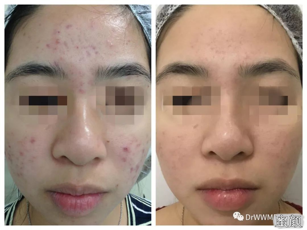 https://img.miyanlife.com/mnt/timg/200805/1206032629-6.jpg