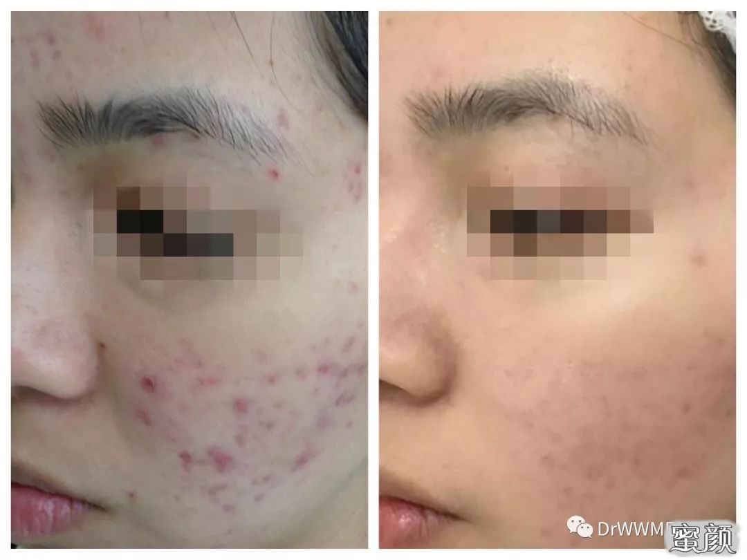 https://img.miyanlife.com/mnt/timg/200805/12060420J-8.jpg