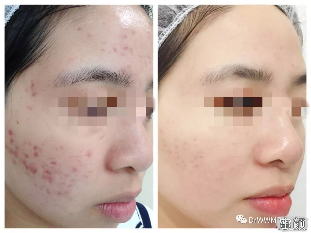 https://img.miyanlife.com/mnt/timg/200805/1206042291-7.jpg