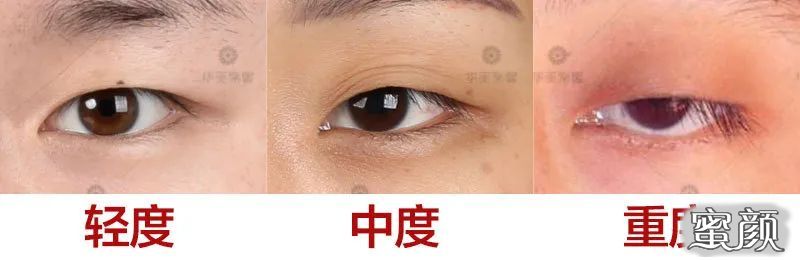 https://img.miyanlife.com/mnt/timg/200805/1215432618-1.jpg