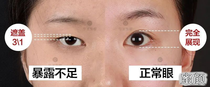 https://img.miyanlife.com/mnt/timg/200805/12154330H-0.jpg