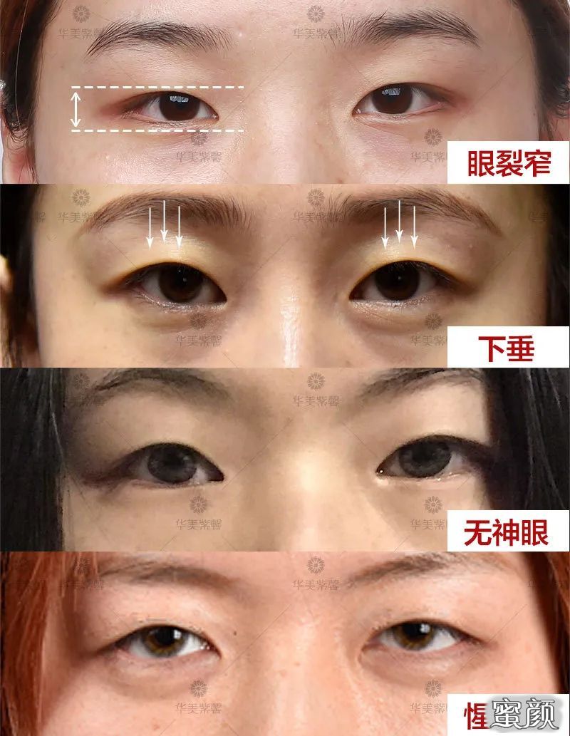 https://img.miyanlife.com/mnt/timg/200805/1215444411-2.jpg