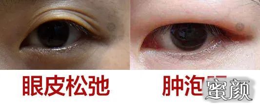 https://img.miyanlife.com/mnt/timg/200805/12154A422-7.jpg