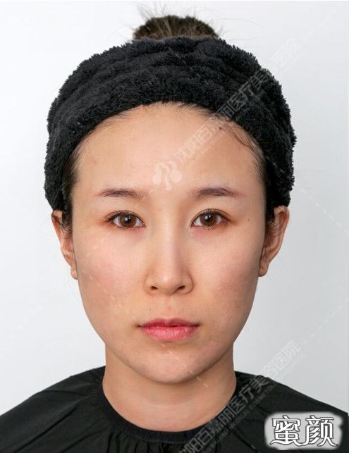 https://img.miyanlife.com/mnt/timg/200806/1103152008-1.jpg