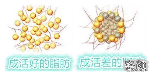 https://img.miyanlife.com/mnt/timg/200806/11434BE7-0.jpg