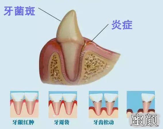 案例图片