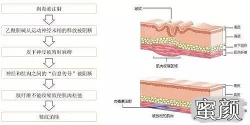 https://img.miyanlife.com/mnt/timg/200811/1151115D5-1.jpg