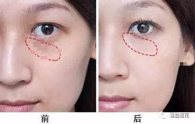 https://img.miyanlife.com/mnt/timg/200811/115112IP-2.jpg