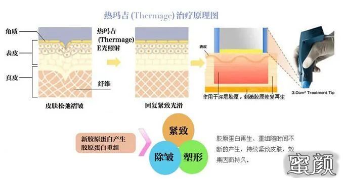 https://img.miyanlife.com/mnt/timg/200812/103FMY8-0.jpg