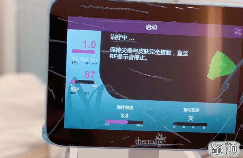 https://img.miyanlife.com/mnt/timg/200812/103G212M-2.jpg