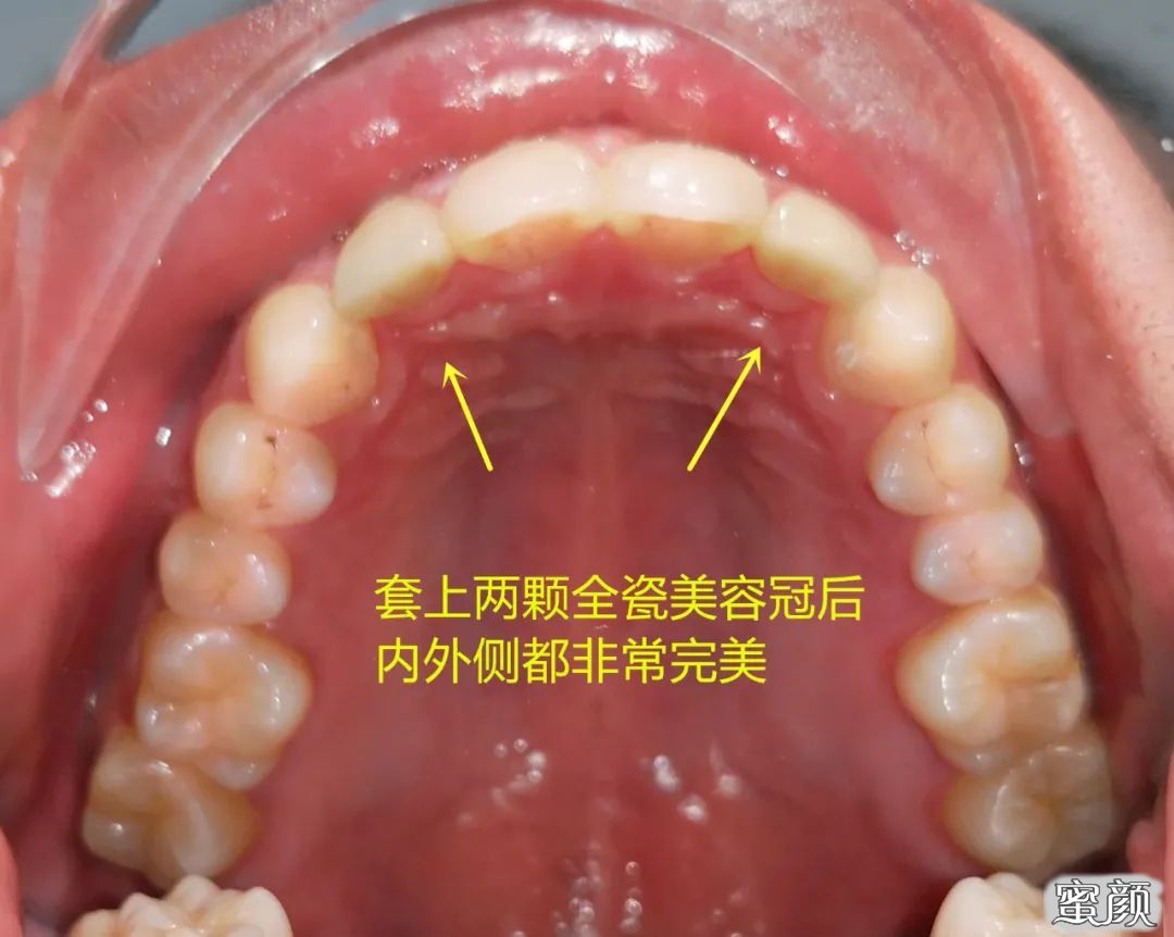 案例图片