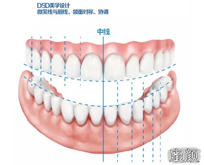 案例图片