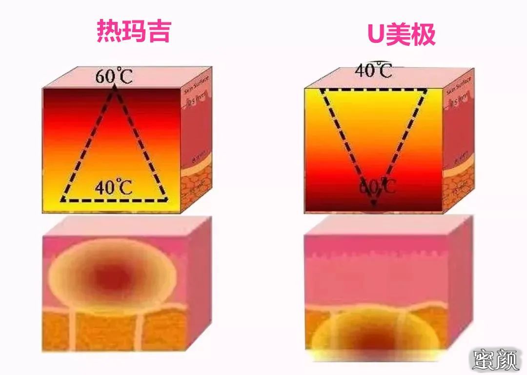 https://img.miyanlife.com/mnt/timg/200820/13224R147-2.jpg