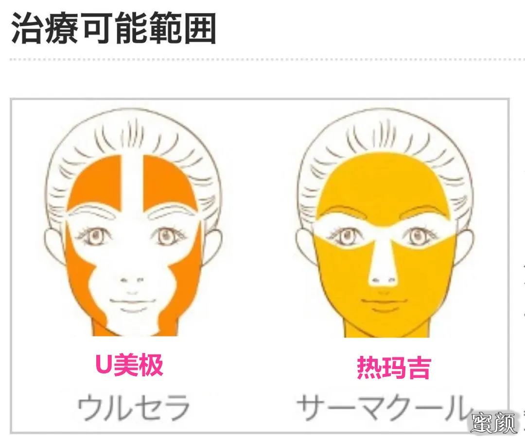 https://img.miyanlife.com/mnt/timg/200820/13230922Q-6.jpg