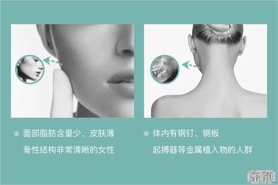 https://img.miyanlife.com/mnt/timg/200821/12291430T-0.jpg