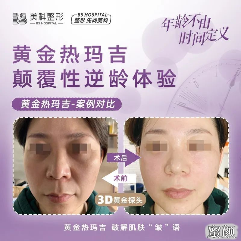 https://img.miyanlife.com/mnt/timg/200823/1420051I9-4.jpg
