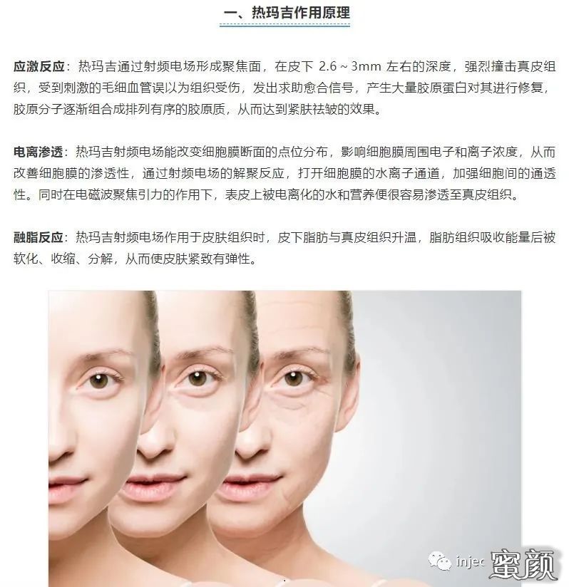 https://img.miyanlife.com/mnt/timg/200823/1426435019-1.jpg