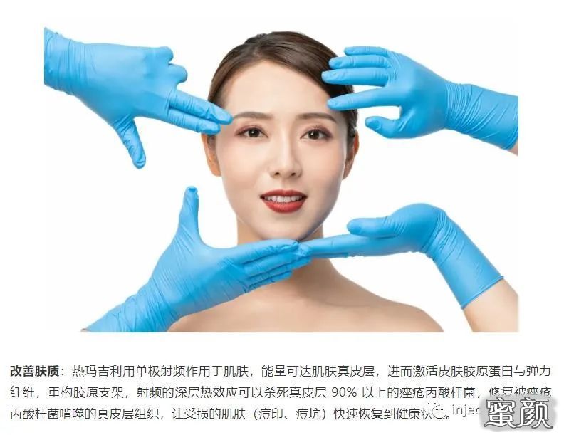 https://img.miyanlife.com/mnt/timg/200823/1426494Y9-4.jpg