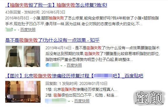 https://img.miyanlife.com/mnt/timg/200829/12493G630-0.jpg
