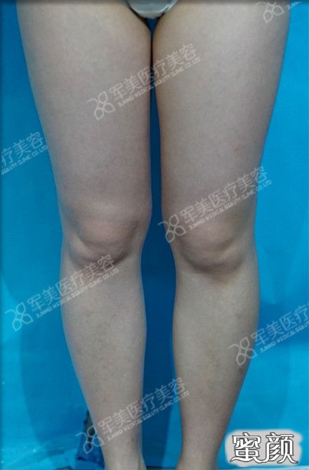 https://img.miyanlife.com/mnt/timg/200829/1249421M6-1.jpg