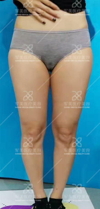 https://img.miyanlife.com/mnt/timg/200829/1249502528-5.jpg
