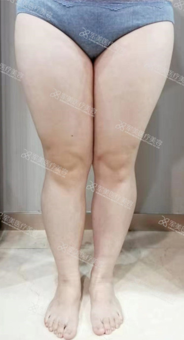 https://img.miyanlife.com/mnt/timg/200829/12495535b-7.jpg