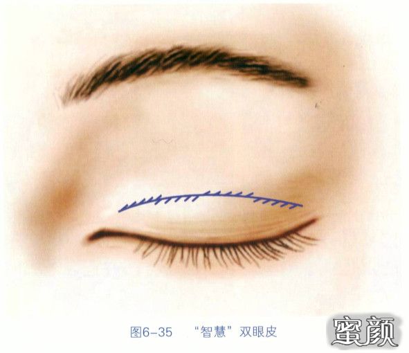 https://img.miyanlife.com/mnt/timg/200829/125612HD-2.jpg